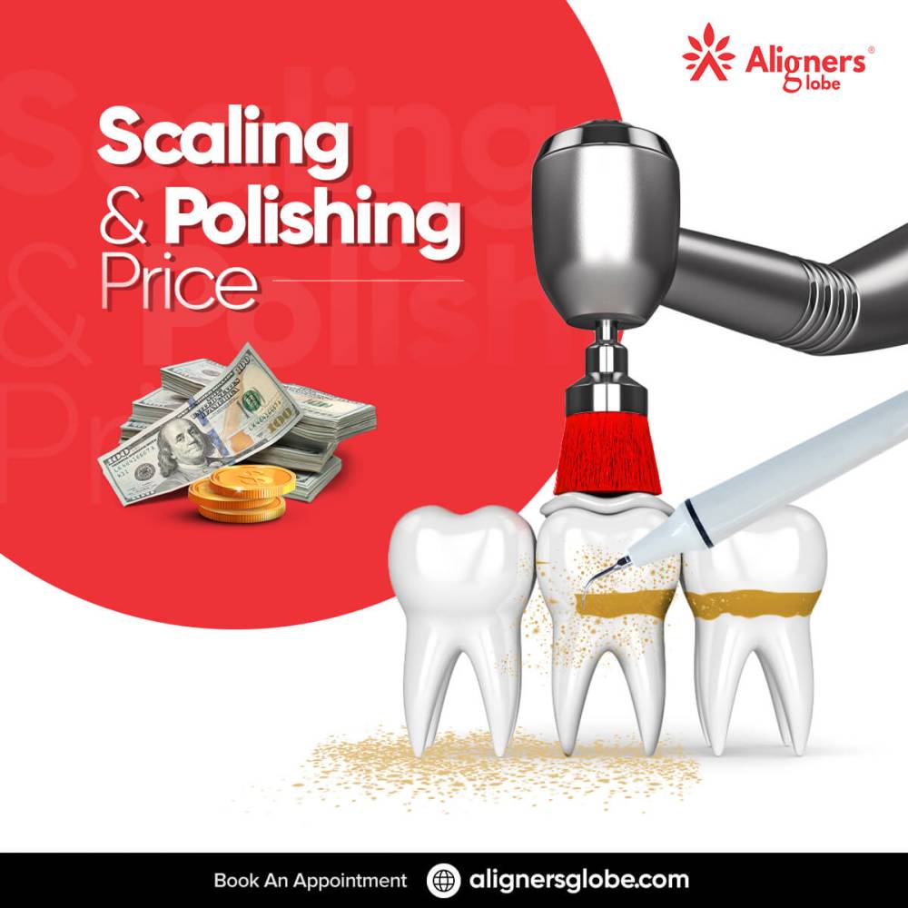 Scaling and Polishing Price | Teeth Polishing Price | Teeth Polishing Cost