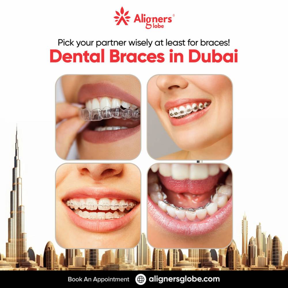 Types Of Dental Braces In Dubai | Aligners Globe